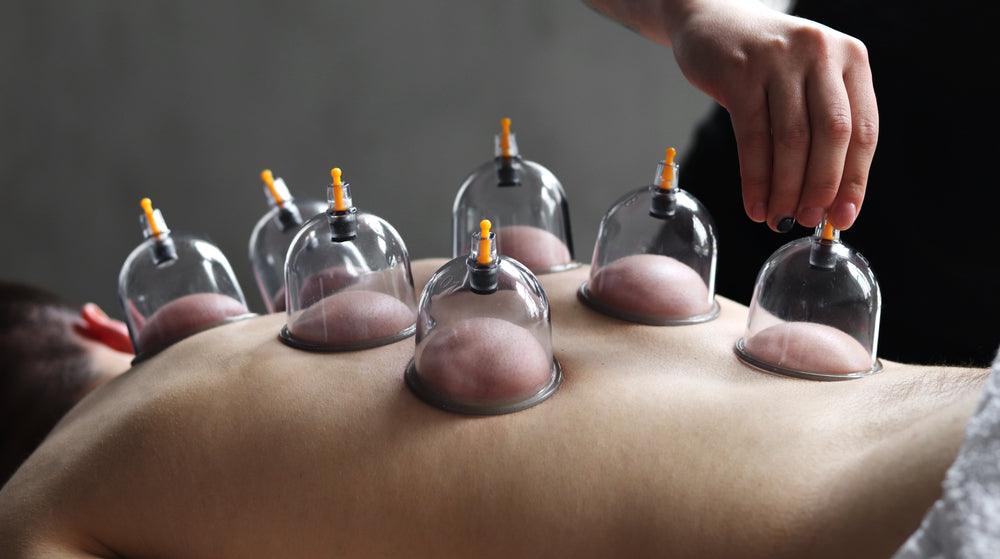 Cupping Therapy And Its Wonders On These Four Health Conditions - Revomadic